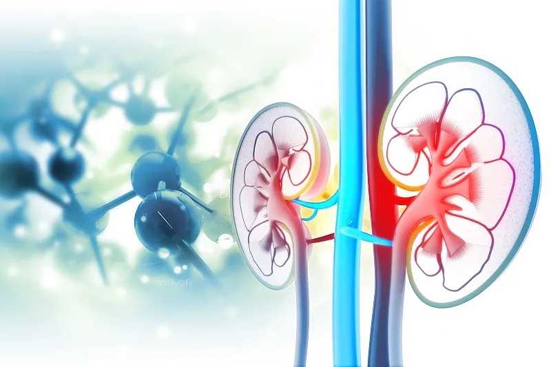 慢性腎病第四階段：原因、癥狀和治療