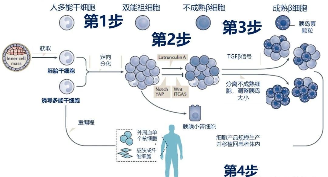 干細胞治療糖尿病的原理和機制 干細胞治療糖尿病的原理和機制