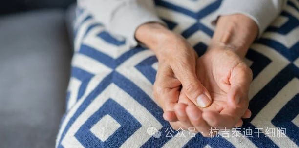 干細胞治療帕金森病