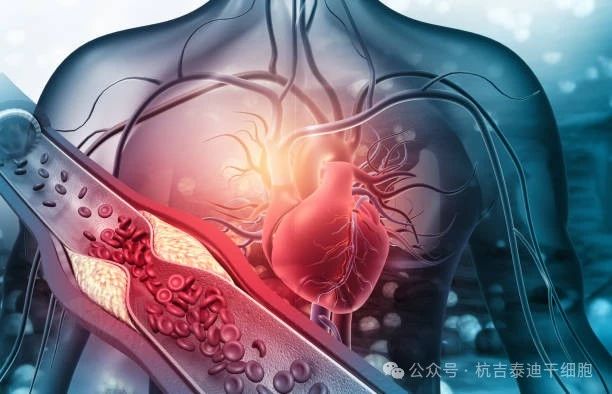 通過(guò)干細胞治療改善心血管疾病的5個(gè)簡(jiǎn)單步驟