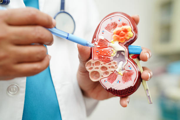 4種診斷慢性腎病方法，你知道幾種？