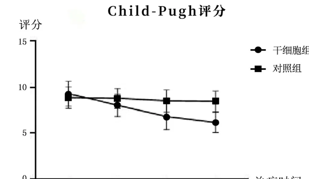 2005年干細胞治療肝硬化臨床案例