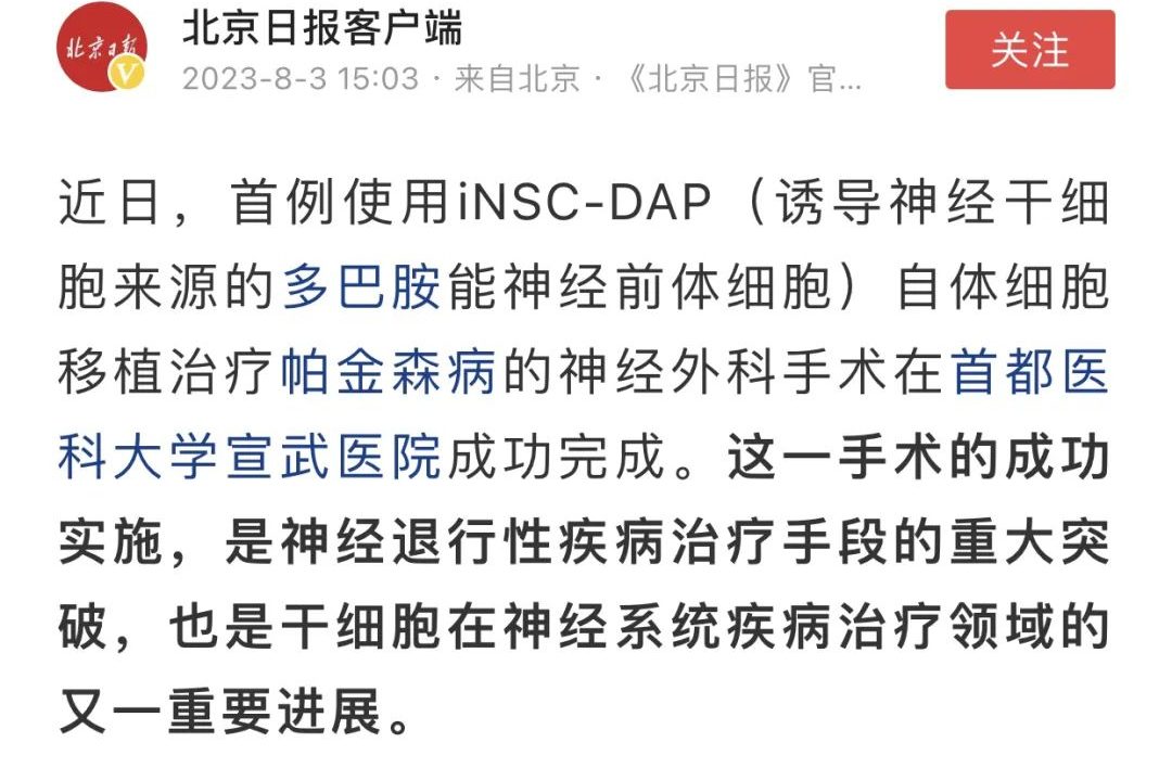 首例使用iNSC-DAP(誘導神經(jīng)干細胞來(lái)源的多巴胺能神經(jīng)前體細胞)自體細胞移植治療帕金森病的神經(jīng)外科手術(shù)在首都醫科大學(xué)宣武醫院成功完成。